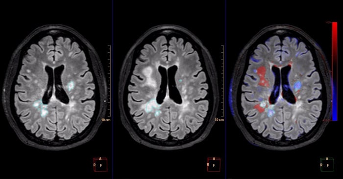 Comparative brain imaging