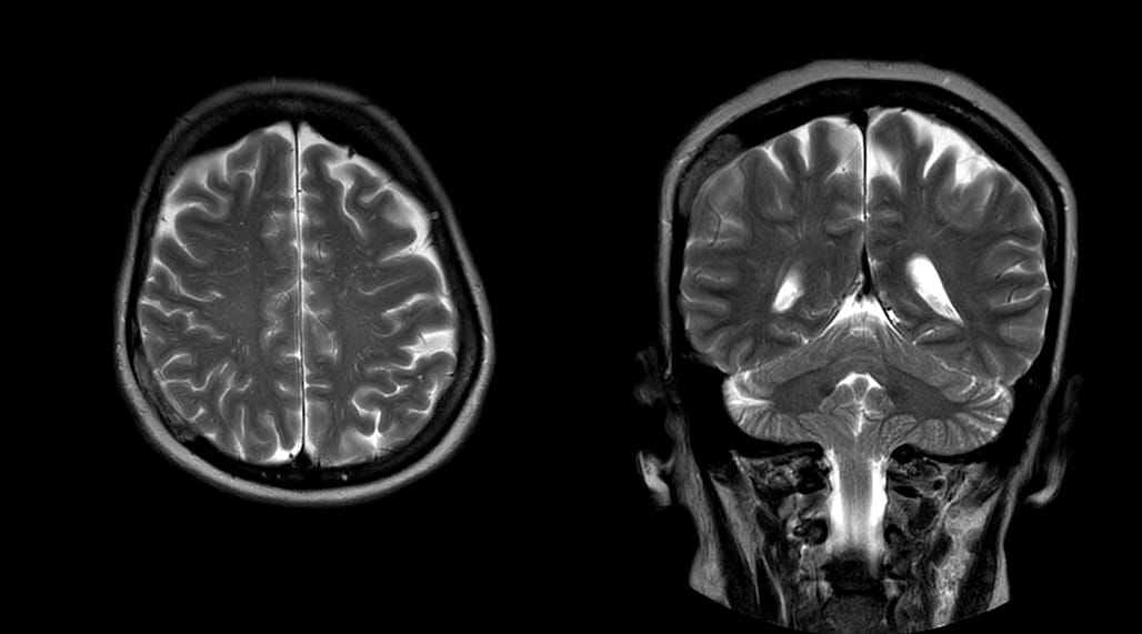 clinical case image