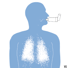 Inhalátor s komôrkou