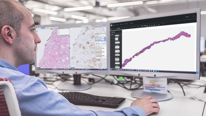 Philips and Paige team up to bring Artificial Intelligence (AI) to clinical pathology diagnostics