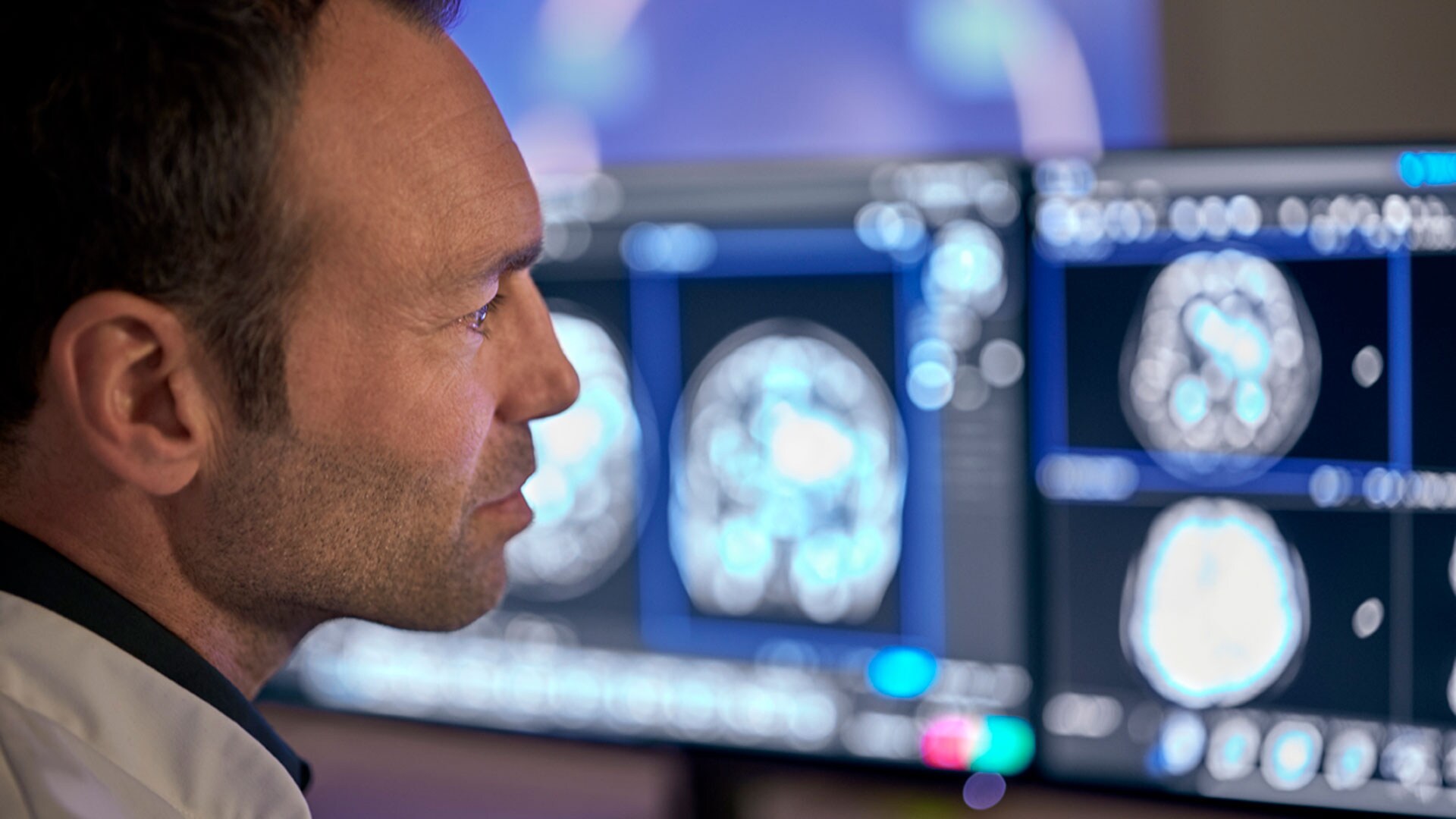 Philips spotlights latest AI-powered, software-defined MR smart systems at ECR 2022